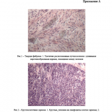 Иллюстрация №2: Патморфология рака матки у суки (Курсовые работы - Ветеринария).